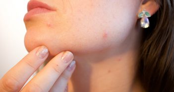 Comment allier produits de beauté et acné ?
